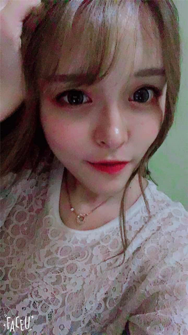 宝宝们，我去做了自体脂肪填充脸部，悄悄告诉你们，别人都看不出来我做了微整哈哈哈~~