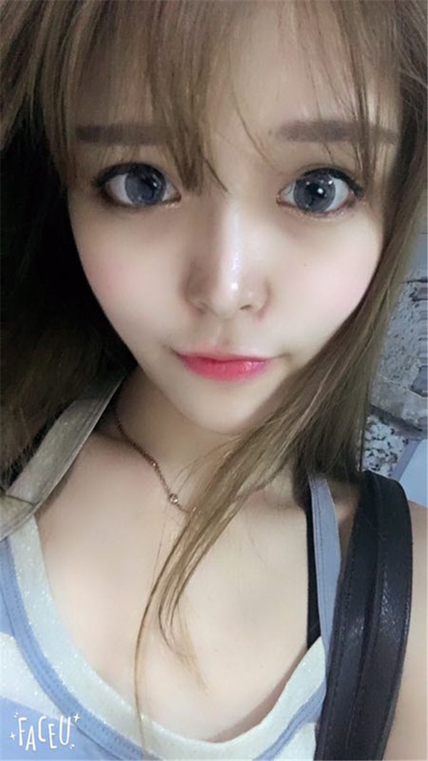 宝宝们，我去做了自体脂肪填充脸部，悄悄告诉你们，别人都看不出来我做了微整哈哈哈~~