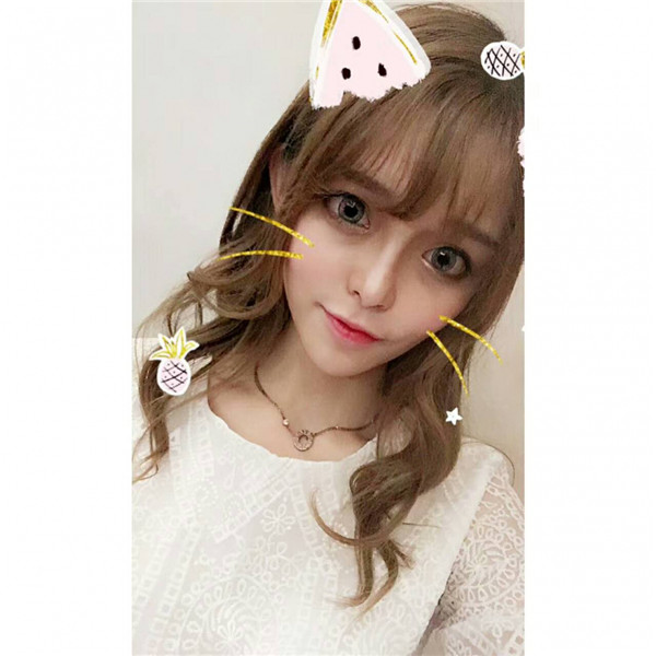 宝宝们，我去做了自体脂肪填充脸部，悄悄告诉你们，别人都看不出来我做了微整哈哈哈~~