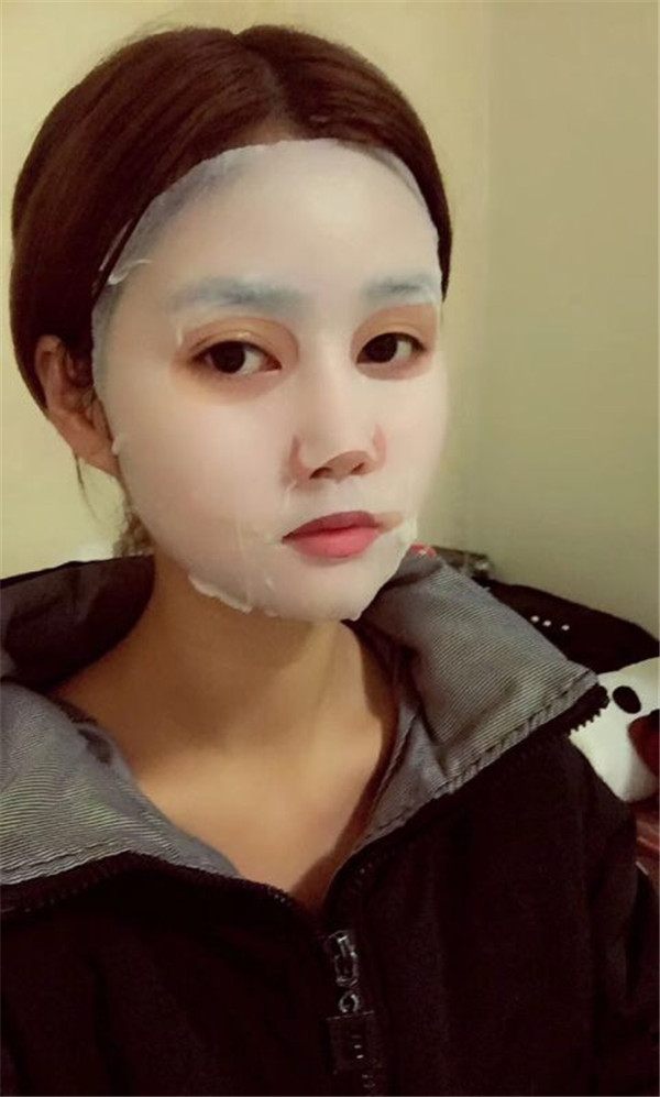 宝宝们,我来分享一下我的自体脂肪填充额头苹果肌,丰太阳穴的经历吧!有很多不懂得地方,希望你们可以多多给我变美的小妙招哦~~~