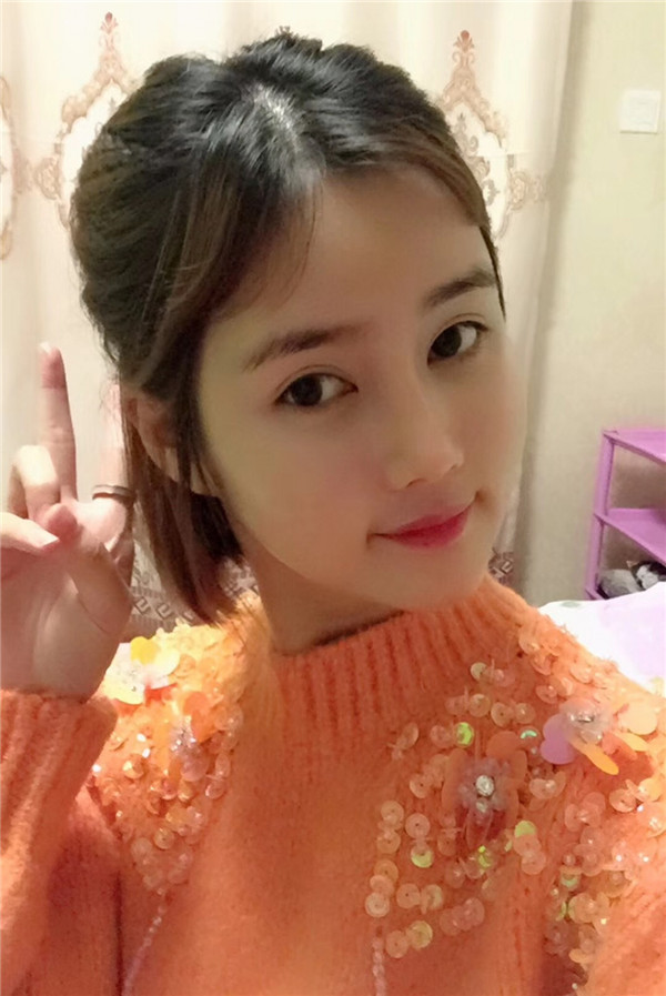 宝宝们,我来分享一下我的自体脂肪填充额头苹果肌,丰太阳穴的经历吧!有很多不懂得地方,希望你们可以多多给我变美的小妙招哦~~~