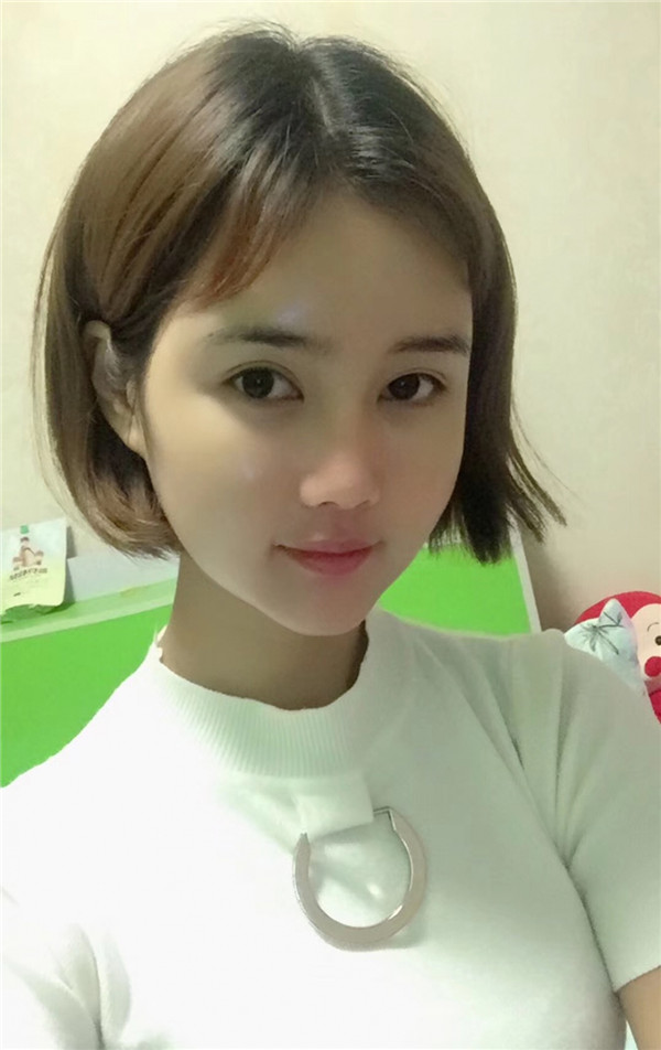 宝宝们,我来分享一下我的自体脂肪填充额头苹果肌,丰太阳穴的经历吧!有很多不懂得地方,希望你们可以多多给我变美的小妙招哦~~~