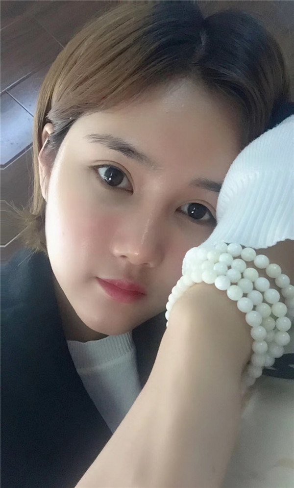 宝宝们,我来分享一下我的自体脂肪填充额头苹果肌,丰太阳穴的经历吧!有很多不懂得地方,希望你们可以多多给我变美的小妙招哦~~~