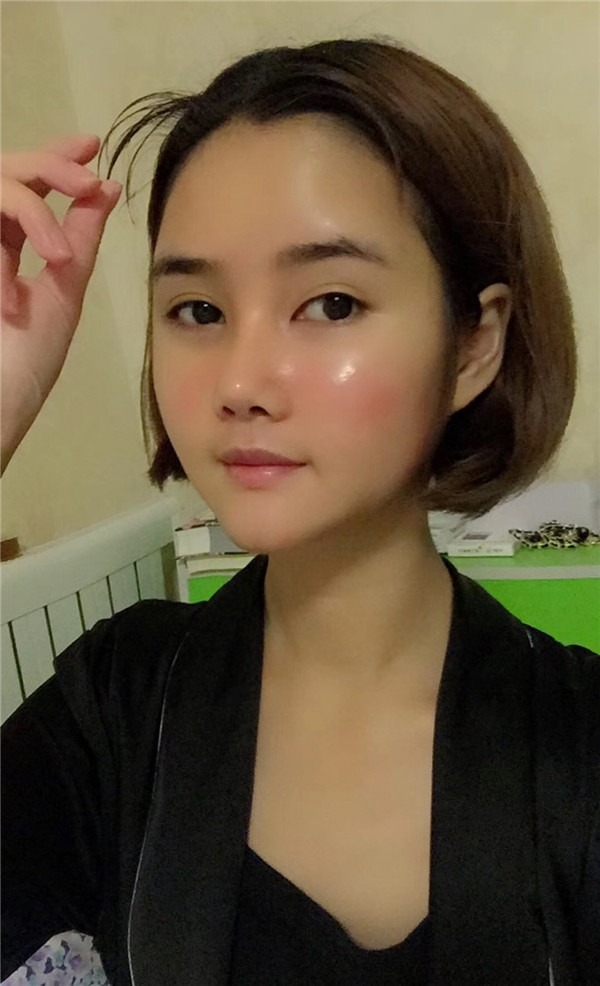 宝宝们,我来分享一下我的自体脂肪填充额头苹果肌,丰太阳穴的经历吧!有很多不懂得地方,希望你们可以多多给我变美的小妙招哦~~~