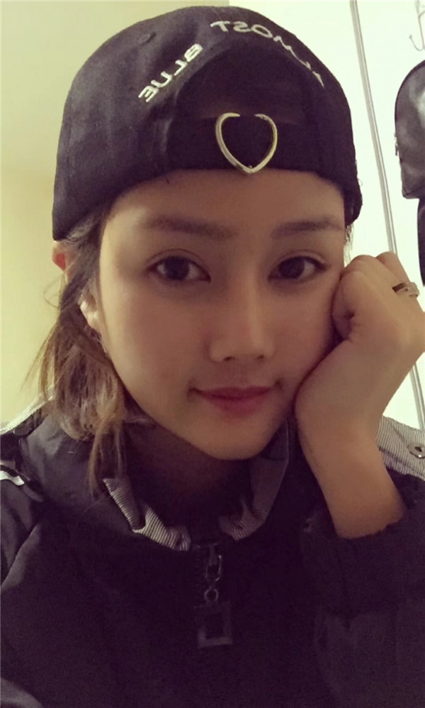 宝宝们,我来分享一下我的自体脂肪填充额头苹果肌,丰太阳穴的经历吧!有很多不懂得地方,希望你们可以多多给我变美的小妙招哦~~~