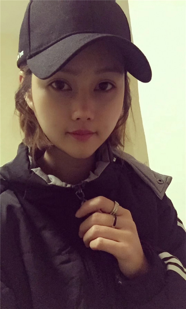 宝宝们,我来分享一下我的自体脂肪填充额头苹果肌,丰太阳穴的经历吧!有很多不懂得地方,希望你们可以多多给我变美的小妙招哦~~~