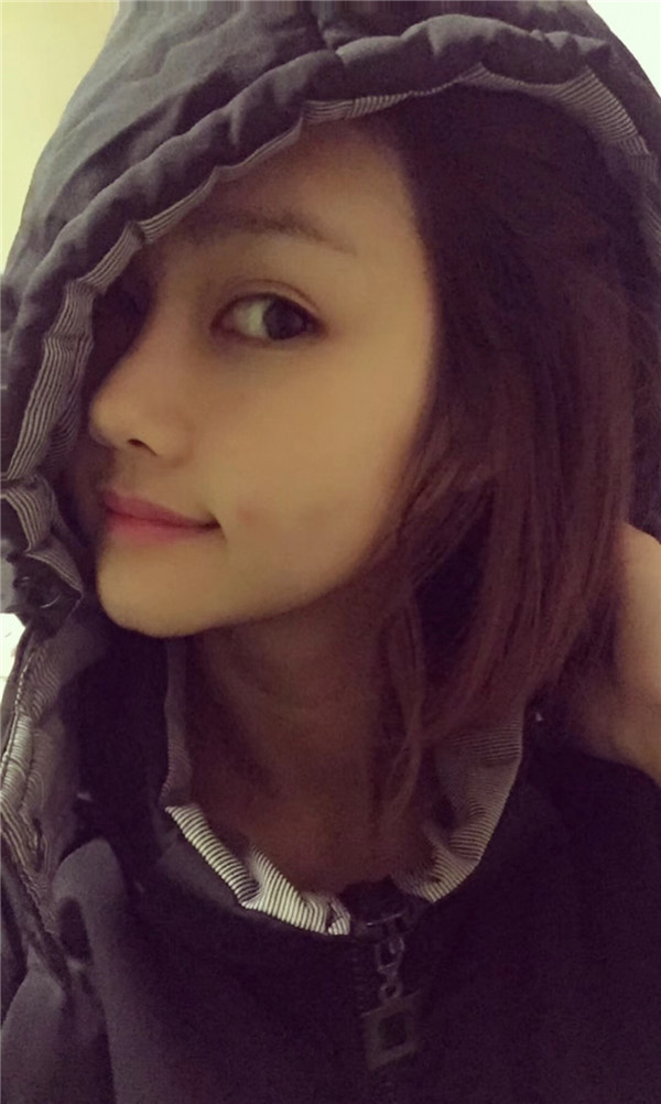 宝宝们,我来分享一下我的自体脂肪填充额头苹果肌,丰太阳穴的经历吧!有很多不懂得地方,希望你们可以多多给我变美的小妙招哦~~~