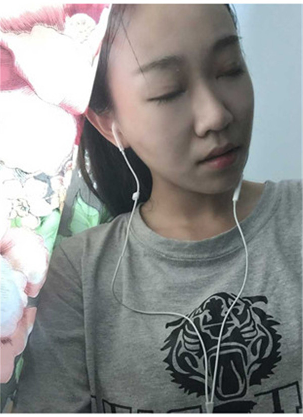 大家早上好,我来分享我的双眼皮经历啦!!都进来看看吧,只要注意忌口和听医生的话,是不会有疤痕的哦~~~