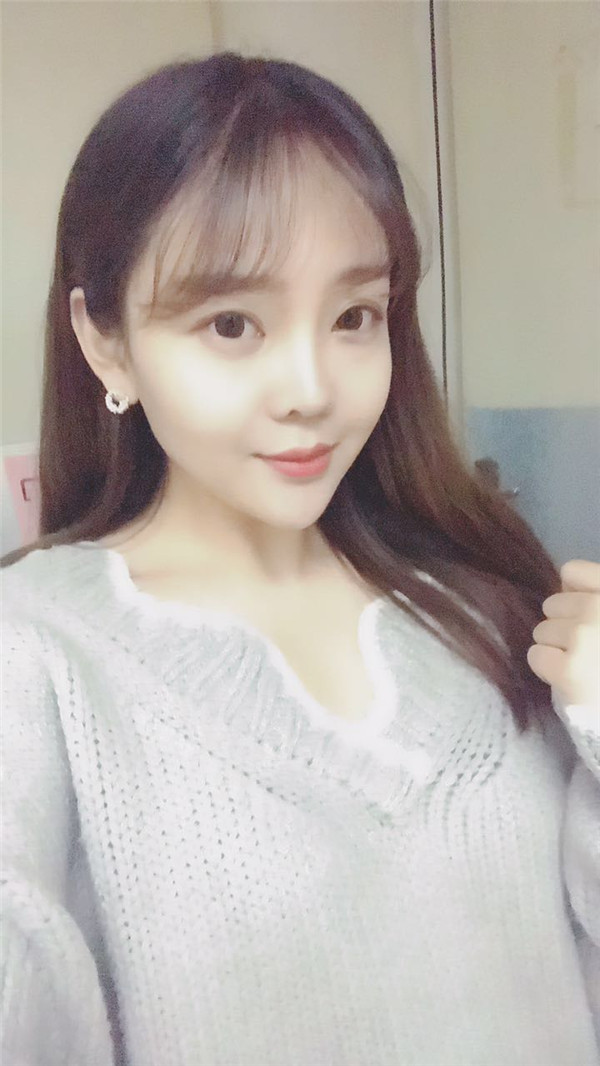 分享我的自体脂肪面部填充经历,我以前的面部情况真的是属于面部凹陷很严重的,整个人看起来真的很憔悴,自从做了面填之后就真的完全改良了我的样貌!