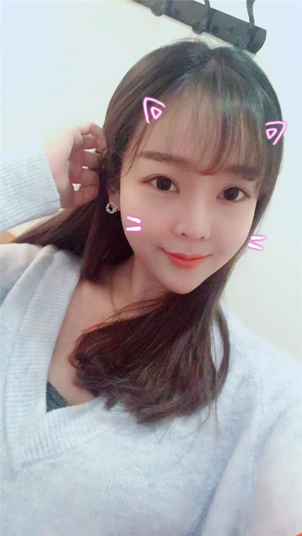 分享我的自体脂肪面部填充经历,我以前的面部情况真的是属于面部凹陷很严重的,整个人看起来真的很憔悴,自从做了面填之后就真的完全改良了我的样貌!