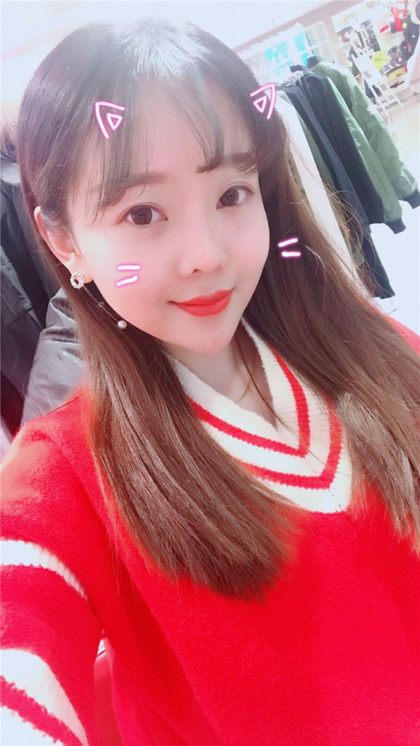 分享我的自体脂肪面部填充经历,我以前的面部情况真的是属于面部凹陷很严重的,整个人看起来真的很憔悴,自从做了面填之后就真的完全改良了我的样貌!