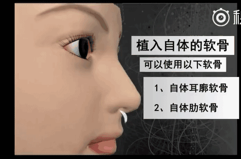 眼下流行的韩式小翘鼻，你真能hold的住吗？