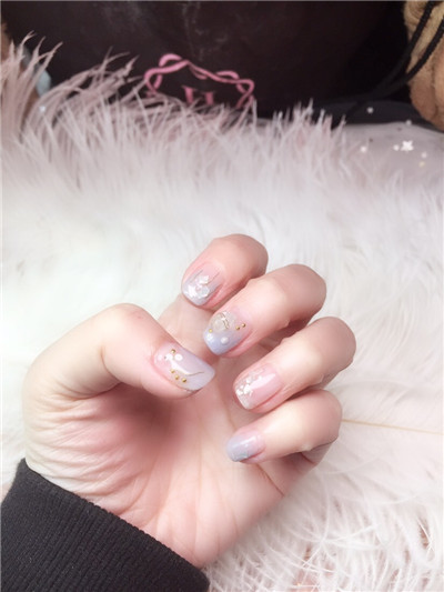 成都艺星光纤溶脂瘦脸经历分享，大脸猫变成小V脸