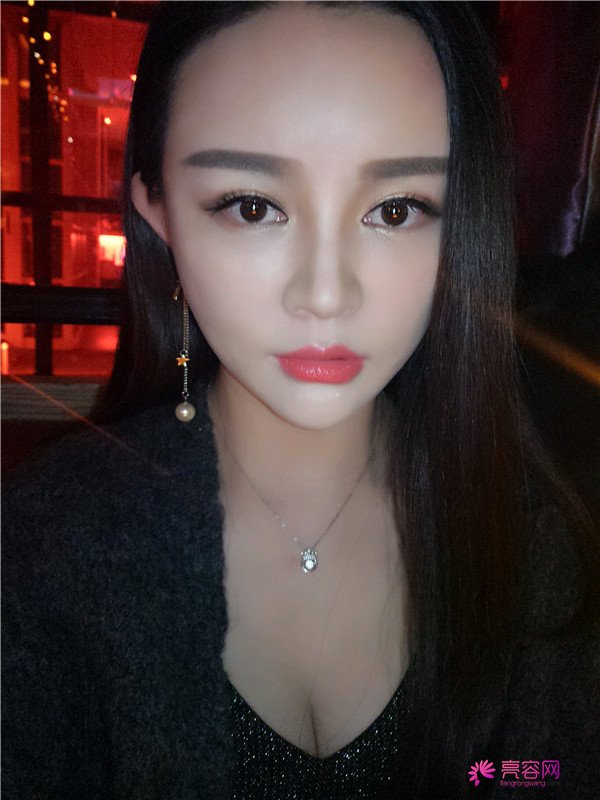 给你们分享我的自体脂肪填充胸部案例!哈喽美女们,你们觉得胸部对一个女人来说重要吗?进来看看我的案例吧~~~ 不看会后悔哦