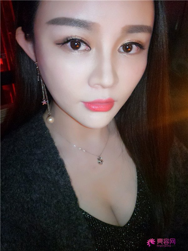 给你们分享我的自体脂肪填充胸部案例!哈喽美女们,你们觉得胸部对一个女人来说重要吗?进来看看我的案例吧~~~ 不看会后悔哦