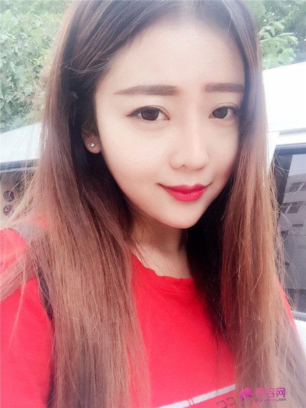 北京自体脂肪填充医院案例术后反馈分享,果怎么样?价格多少钱?一看便知!