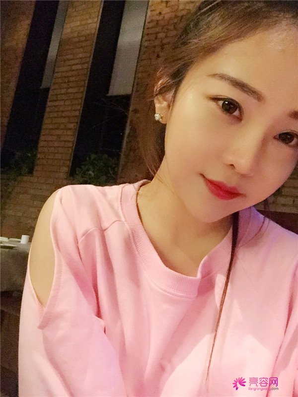 北京自体脂肪填充医院案例术后反馈分享,果怎么样?价格多少钱?一看便知!