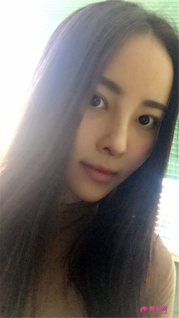我来和大家分享我的隆鼻日记了,我自己恢复得不错,所以放心大胆的将自己的鼻子交给医院啦~