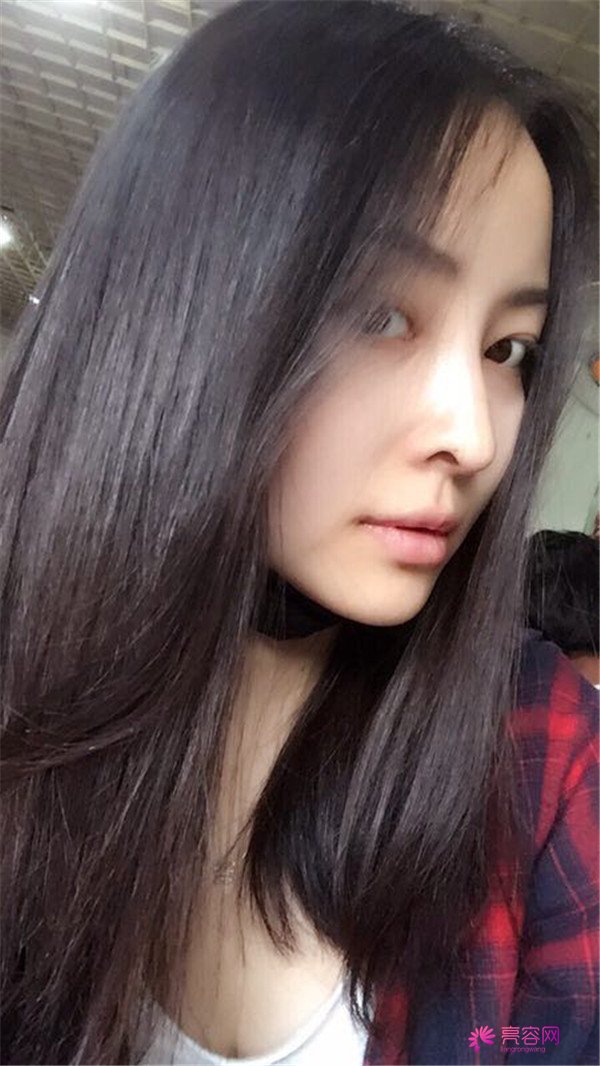 我来和大家分享我的隆鼻日记了,我自己恢复得不错,所以放心大胆的将自己的鼻子交给医院啦~