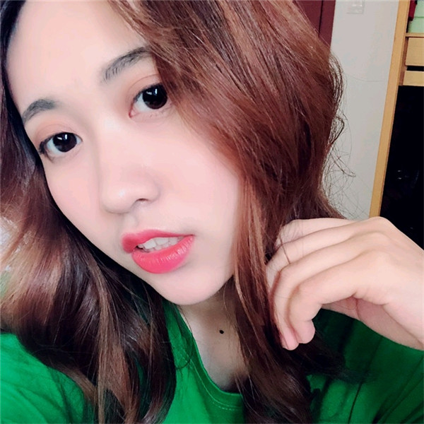 重庆万家燕鸿源王珍祥自体脂肪丰额头案例分享附太阳穴不饱满怎么办?