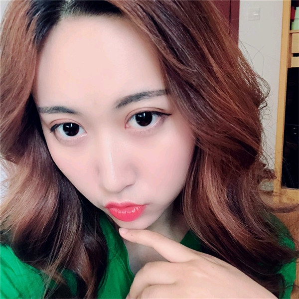 重庆万家燕鸿源王珍祥自体脂肪丰额头案例分享附太阳穴不饱满怎么办?