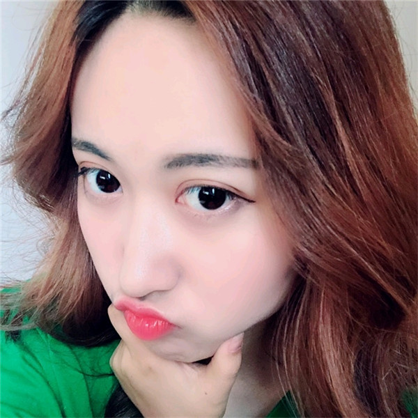 重庆万家燕鸿源王珍祥自体脂肪丰额头案例分享附太阳穴不饱满怎么办?