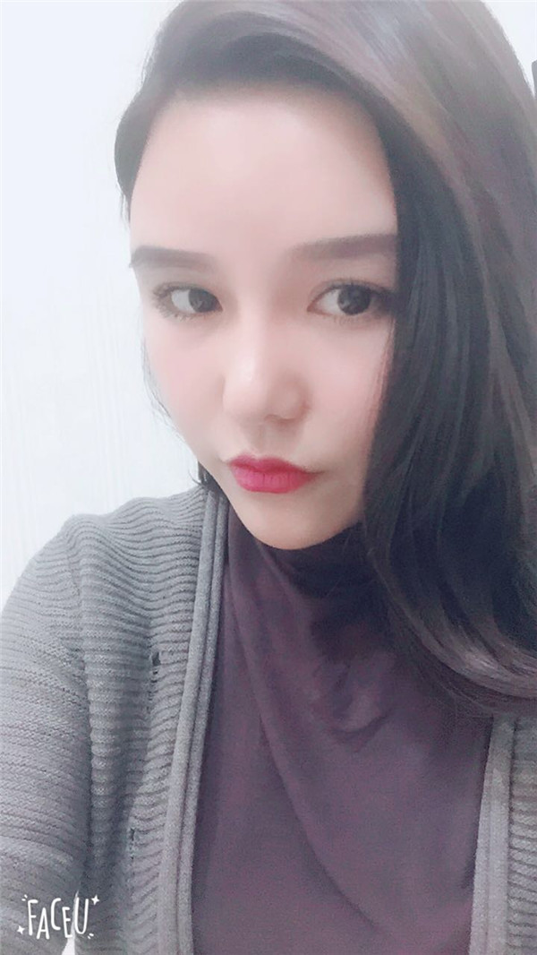 郑州华领张永涛自体脂肪全脸填充案例分享附自体脂肪填充法改善法令纹好吗?