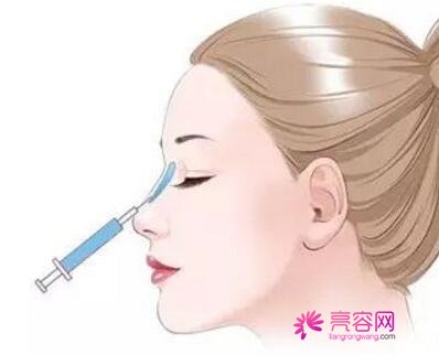 南昌爱思特隆鼻怎么样?价格案例分享