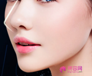 郑州美莱隆鼻怎么样?价格案例分享