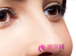 石家庄雅芳亚隆鼻怎么样?价格案例分享
