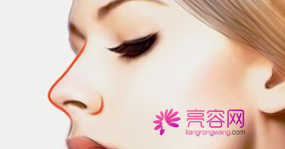 成都娇点李竞隆鼻怎么样?价格案例分享