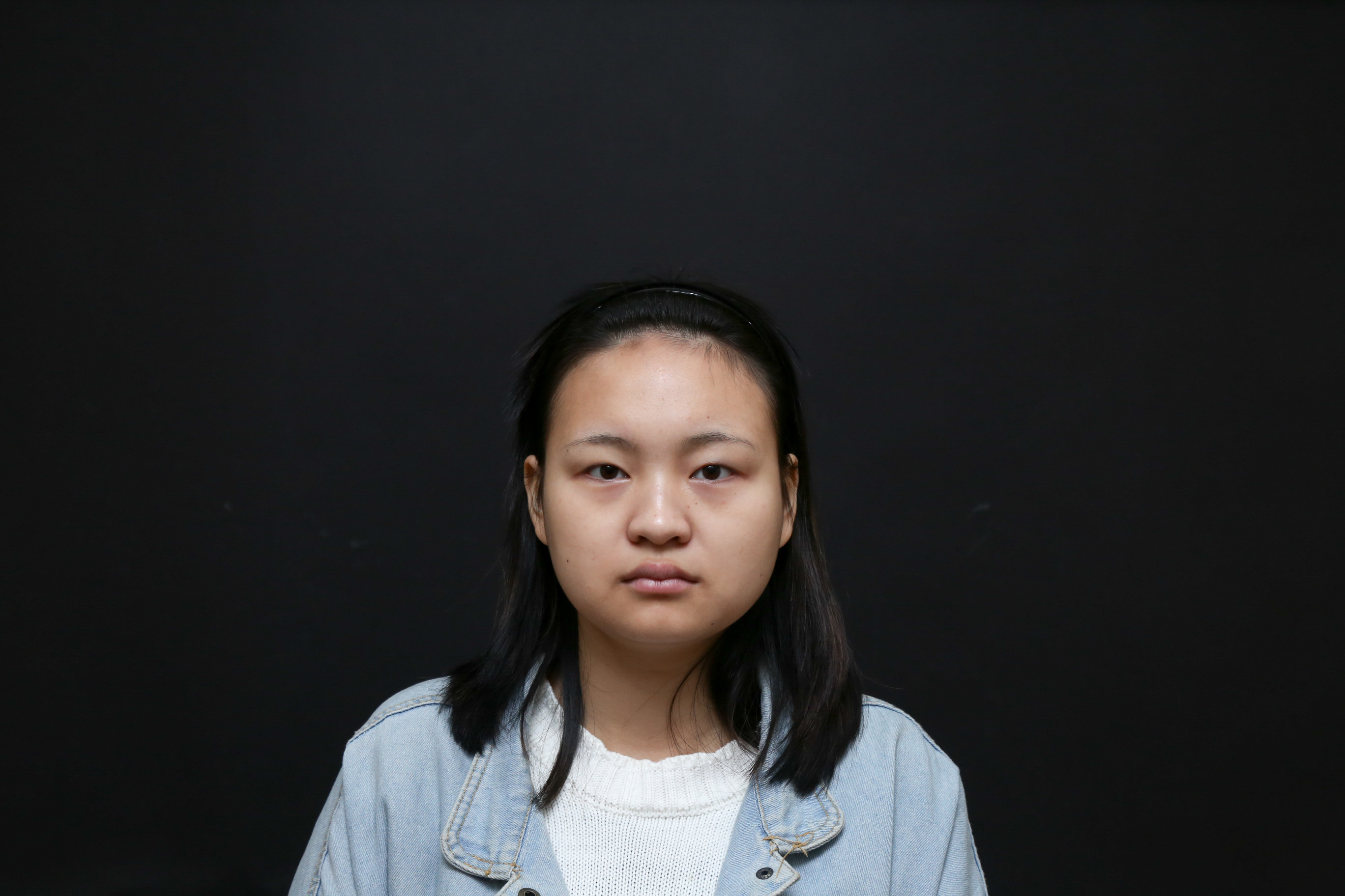 武汉美基元 美基元眼部综合案例 案例