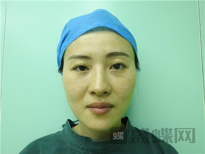 北京百达丽,苏婷,,案例,价格,