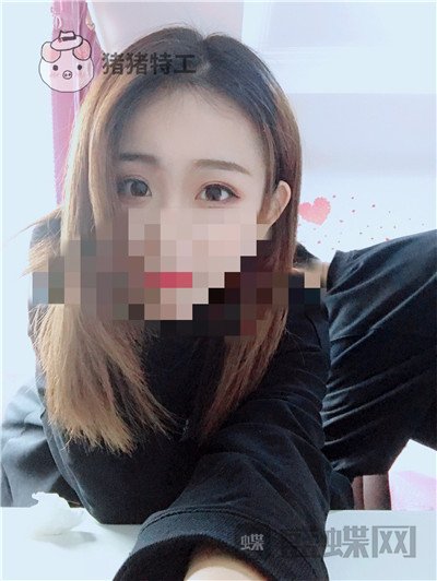 杭州美莱,韩超,双眼皮,案例,价格,