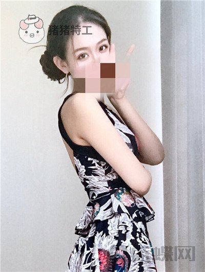 杭州美莱,韩超,双眼皮,案例,价格,