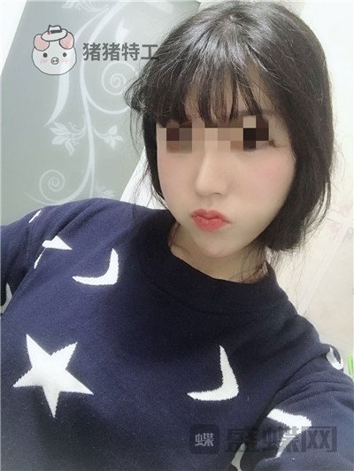 北京润美玉之光，王明利，面部填充，案例，价格，