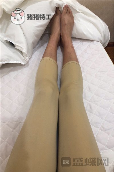 昆明梦想整形李成龙吸脂案例价格分享，小象腿到筷子腿的蜕变~