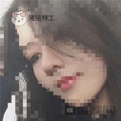 上海百达丽,周珍艳,双眼皮,,案例,价格,
