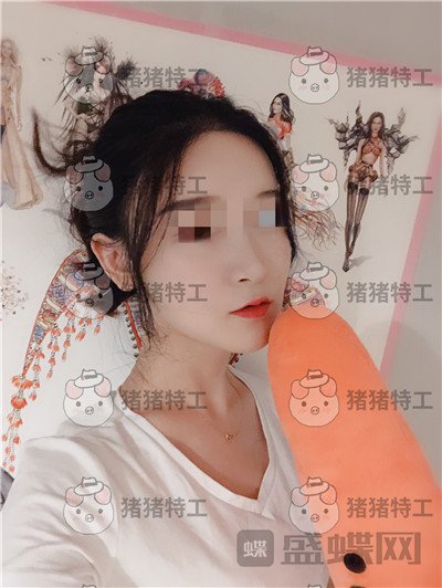 上海华美,李志海,下颌角整形,案例,价格,