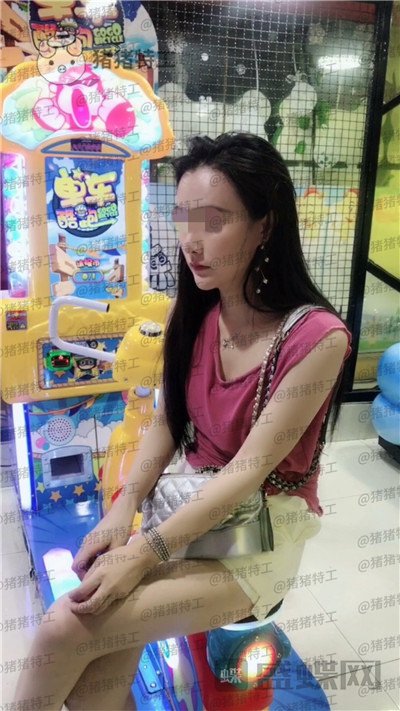 上海华美,李志海,下颌角整形,案例,价格,