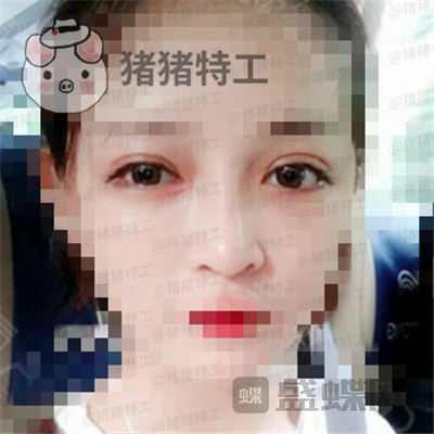 上海九院,魏皎,,案例,价格,