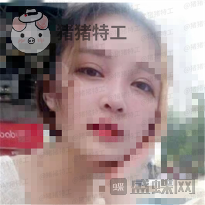 上海九院,魏皎,,案例,价格,