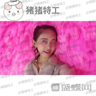 北京长虹赵宏伟隆鼻案例价格分享，赵医生做的鼻子真的太自然了很喜欢！