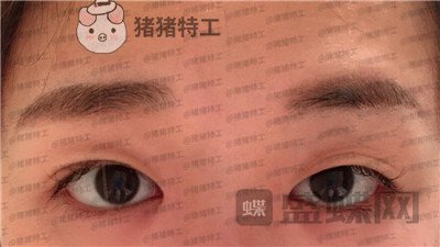 兰州时光,罗梅,,案例,价格,
