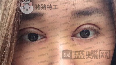 兰州时光,罗梅,,案例,价格,
