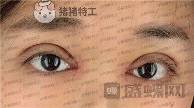 兰州时光,罗梅,,案例,价格,