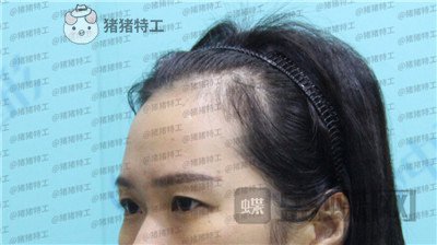 武汉中爱铭医,祁向峰,,案例,价格,