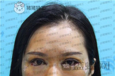 武汉中爱铭医,祁向峰,,案例,价格,