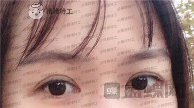 武汉中爱铭医,祁向峰,,案例,价格,