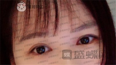 武汉中爱铭医,祁向峰,,案例,价格,